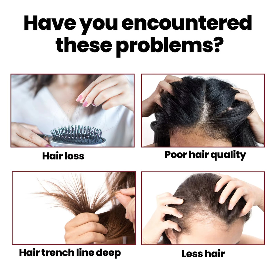 OUHOE Haarwiederherstellungsserum, 50 ml, für trockenes und strapaziertes Haar - Bild 5