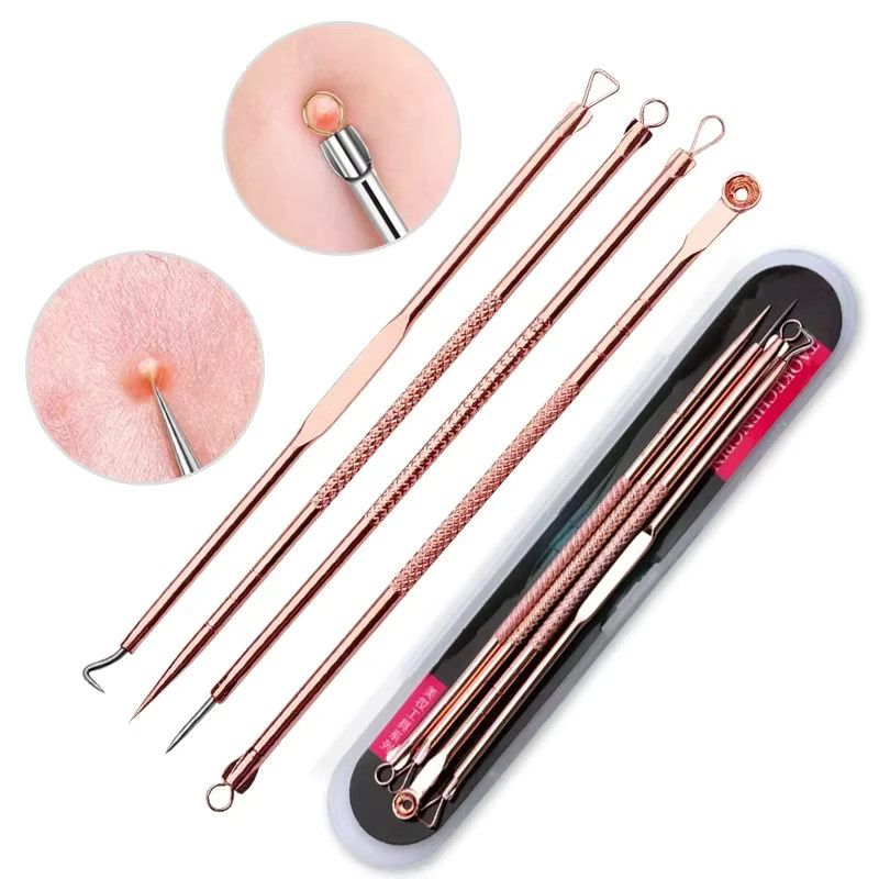 RUZOFO Mitesser-Entferner-Set, 4-teilig, Unisex, für unreine Haut - Bild 1