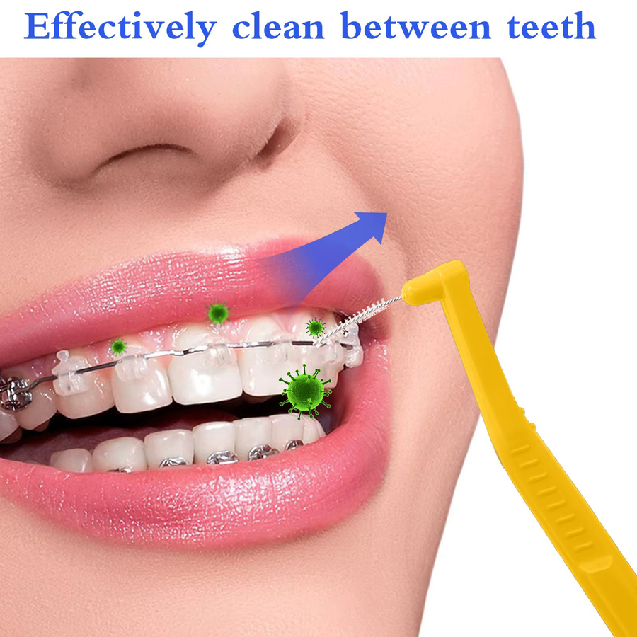 5er-Set L-förmige Interdentalbürsten zur Mundhygiene und Zahnreinigung - Bild 3