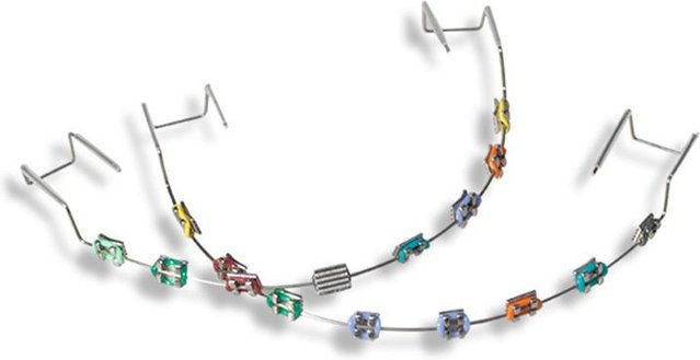 Zahn-Dekorationsset Farbiges Metall-Brackets-Modell, Unisex - Bild 1
