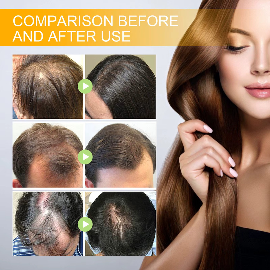 EELHOE Biotin Haarspray, 30 ml, Unisex - Bild 6