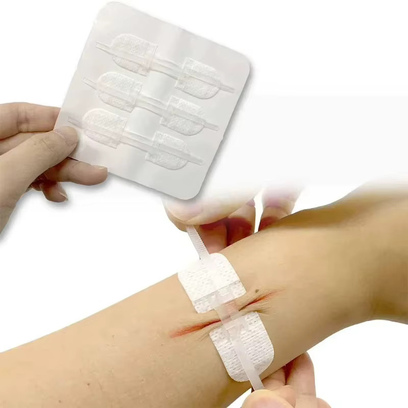 Seap-Free Klebeband für Erwachsene, schmerzloses Wundnahtband mit Reißverschluss, beige - Bild 2