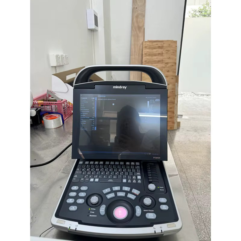 PFP DP-10 Tragbares Laptop-Ultraschallgerät Schwarz-Weiß-Ultraschallscanner in Schwarz und Weiß - Bild 2