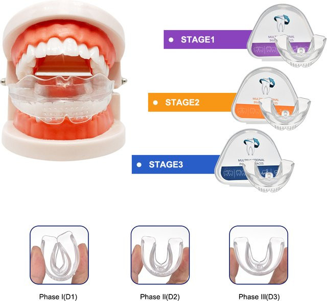 Oralhoe Zahnschienen-Ausrichter Mundstück, 3-Stufen, Unisex - Bild 1