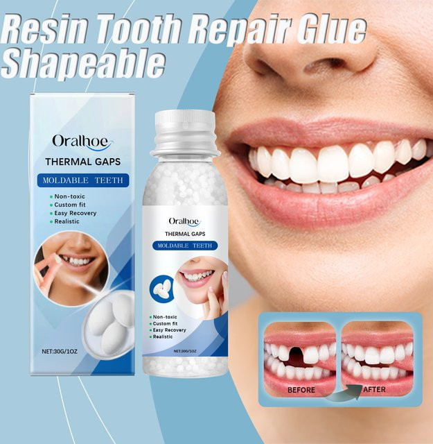 Oralhoe Zahn Reparatur Kleber, Formbare Zähne Lücken Füllung - Bild 1