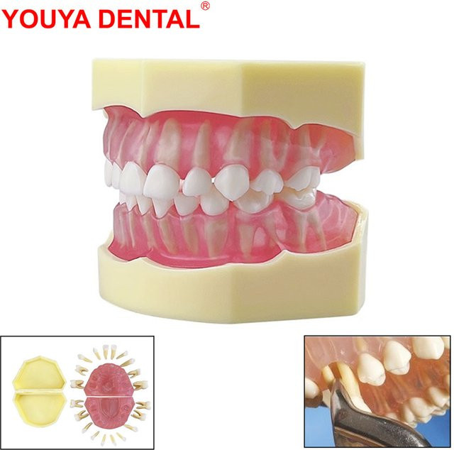 YOUYA DENTAL Kinder Zähne Modell, mit abnehmbaren Zähnen - Bild 1