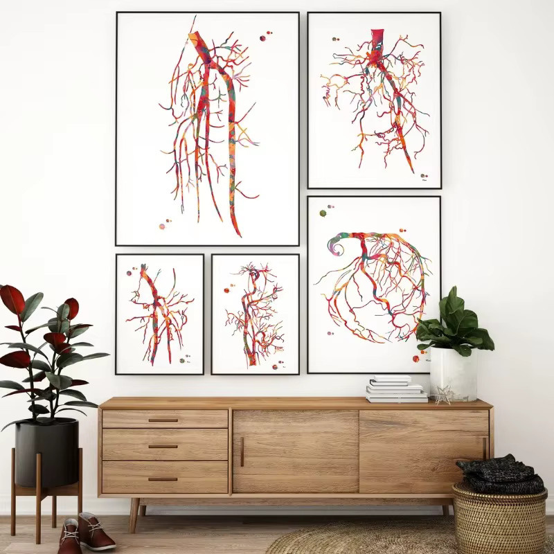 Potdemiel Wandkunst Leinwand Poster Kardiologie Gefäß Anatomie Angiogramm Multicolour - Bild 2