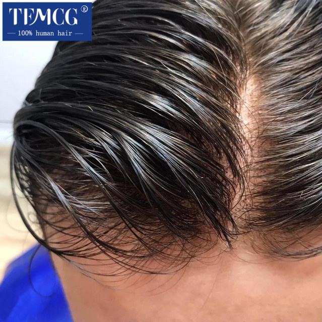 Herren-Haarprothese aus Remy-Echthaar, 0,02-0,03 mm dünne Haut - Bild 1