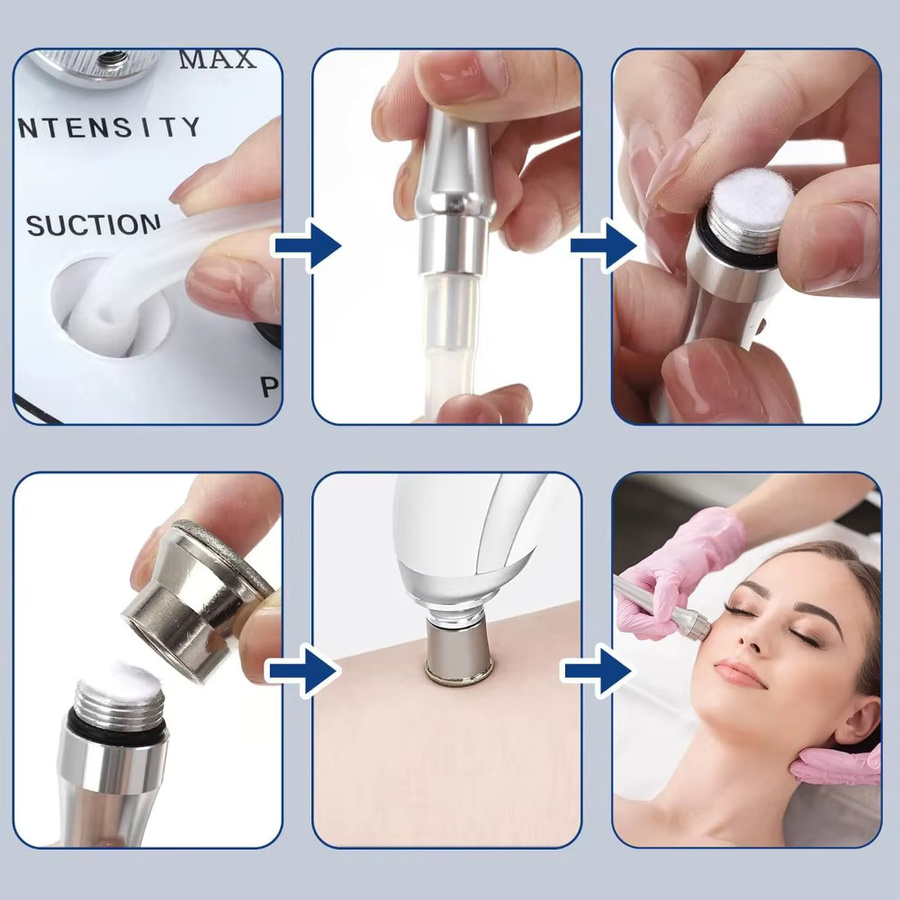 Mikrodermabrasions-Exfoliator, 6-9 Diamant-Dermabrasionsköpfe, Gesicht - Bild 3