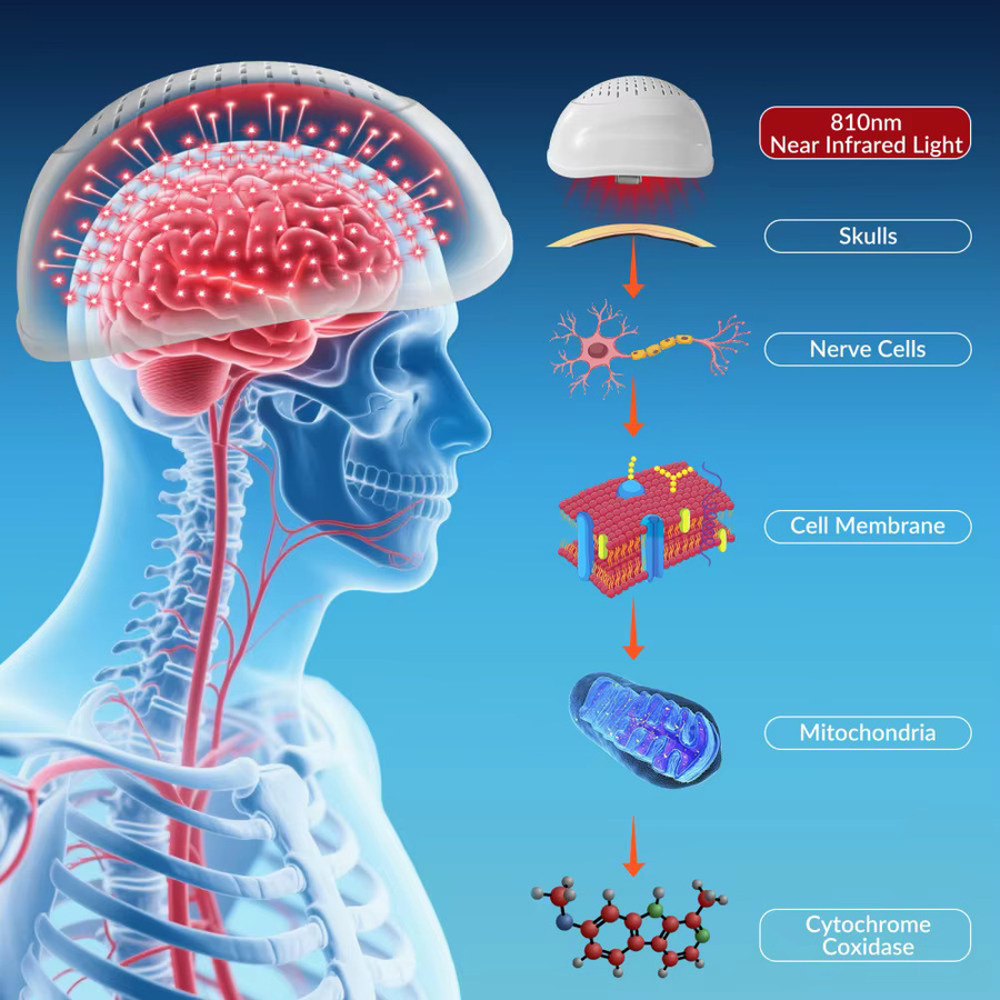 Frovab PBM-Therapiegerät Gehirnstimulations-Helm mit 448 Dioden und 810nm NIR-Licht in Weiß zur Rehabilitation bei Parkinson und Schlaganfall sowie zur Gedächtnisverbesserung - Bild 2