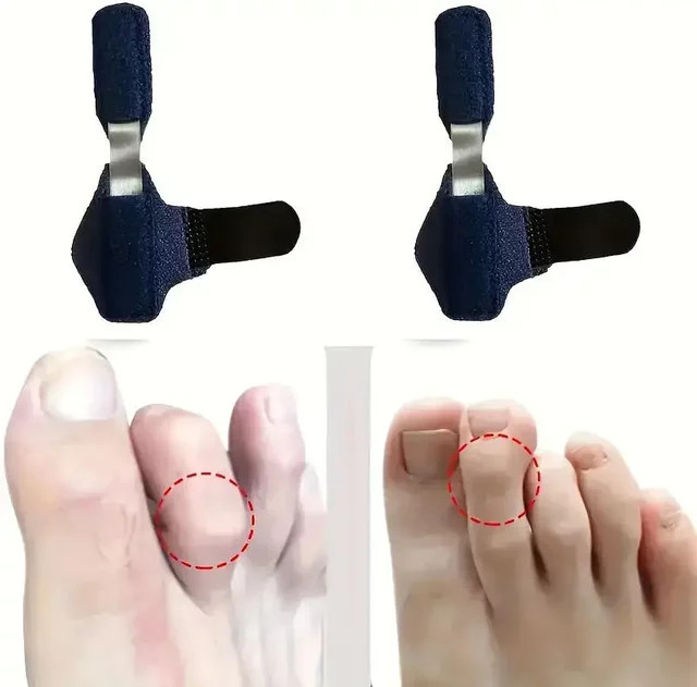 Hammerzehen-Korrektor und -Stabilisator für Kinder und Erwachsene, Unisex - Bild 1