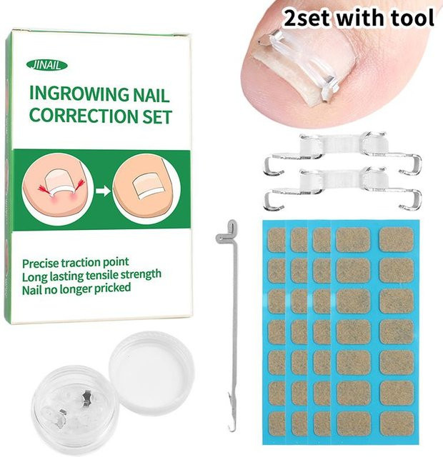 Pediküre Korrekturwerkzeuge für eingewachsene Zehennägel, 1/2 Set, Unisex - Bild 1