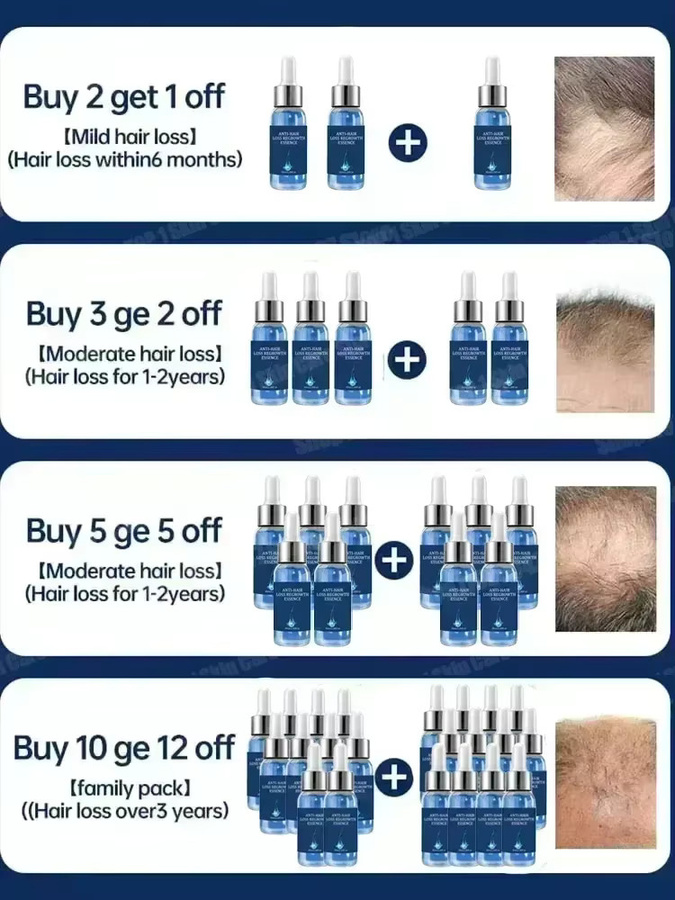 eelhoe Haaröl für spärliches Haar - Bild 6