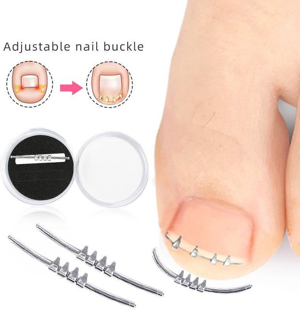 Bombinate Werkzeug zur Korrektur eingewachsener Zehennägel, 2,3 cm, Unisex - Bild 1