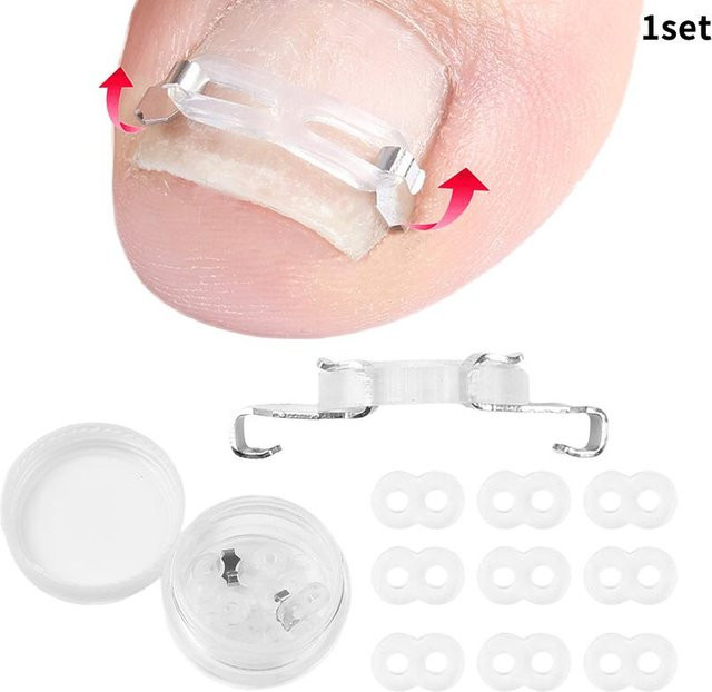 Pediküre Korrekturwerkzeuge für eingewachsene Zehennägel, 1/2 Set, White - Bild 1