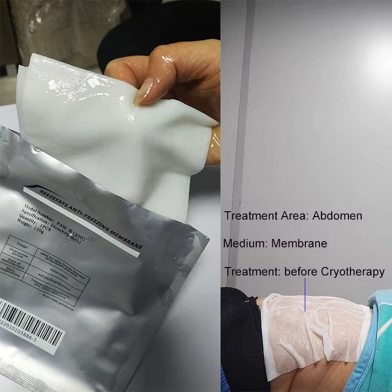 BEHLH Ersatz-Gel-Pads, Anti-Frost-Membranen für Kryotherapie - Bild 1