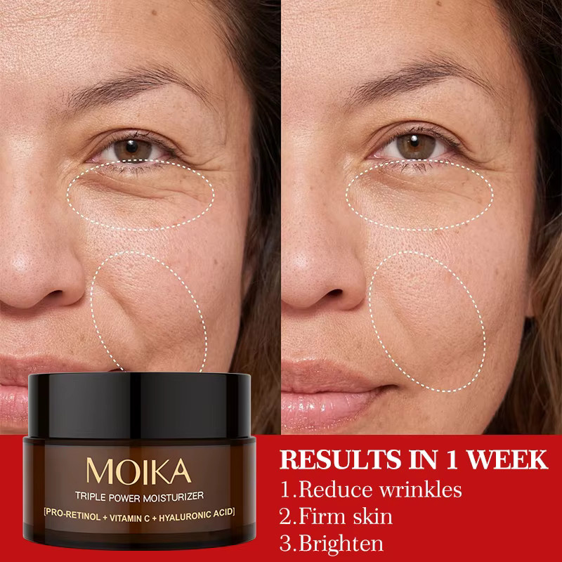 MOIKA Triple Power Feuchtigkeitscreme mit Retinol, Vitamin C und Hyaluronsäure, Fettige Haut - Bild 4