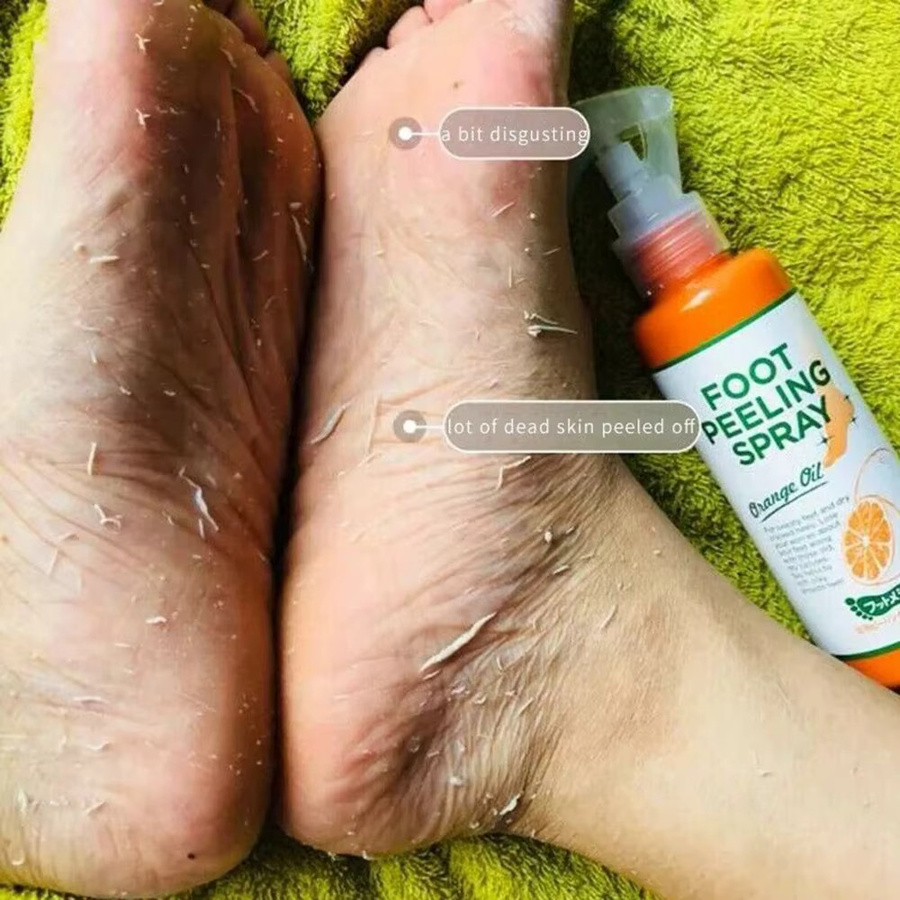 Fußmaske zur Entfernung abgestorbener Haut und Hornhaut, 110 ml - Bild 1