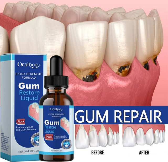 Oralhoe Zahnfleisch-Reparaturserum, Zahnreinigungstropfen - Bild 1