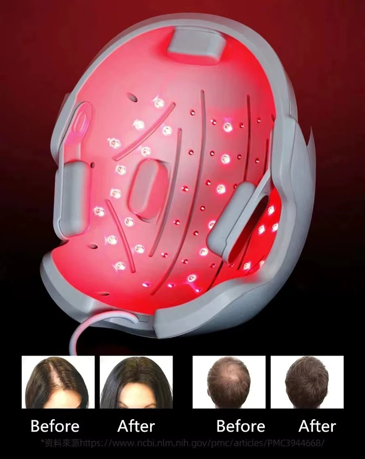 Lescolton Haarwuchs-Kappe, Unisex, Rotlichttherapie, Weiß - Bild 2