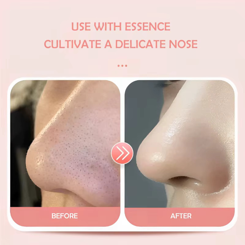 HMQ beauty Einweg-Nasenmasken, 100 Stück, Unisex - Bild 2