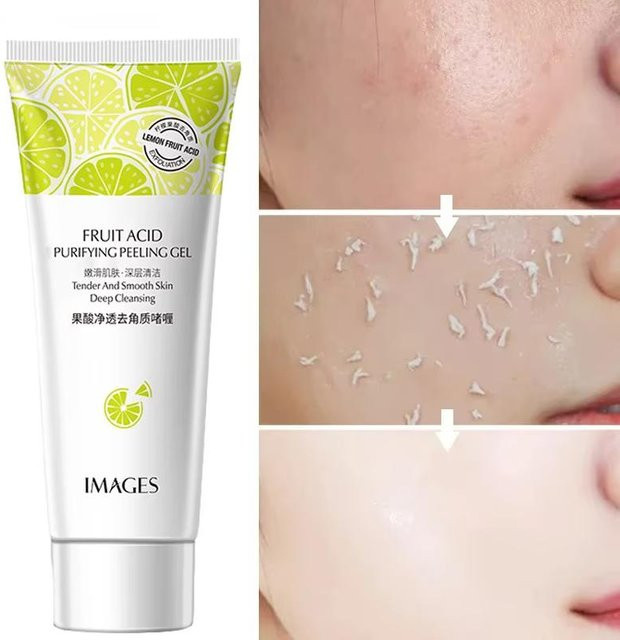 NiNi02 Fruchtsäure Peeling Gel mit AHA, Gesicht, Unisex - Bild 1