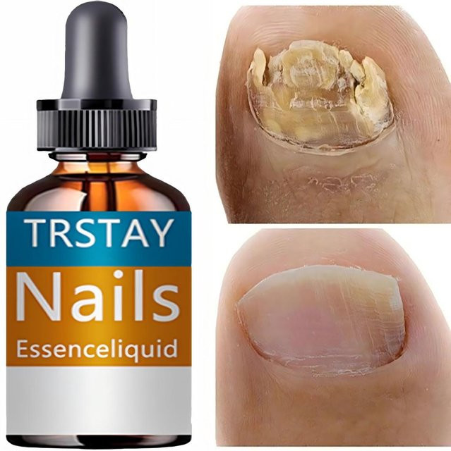 Nagel Wunder Nagelhärter mit Keratin, 5 ml, glänzend - Bild 1
