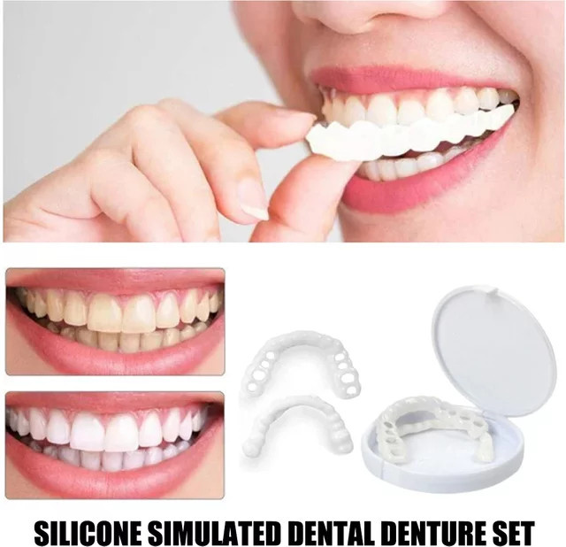 Dentsmile Beauty Veneer Kit, Unisex, 8 Sets - Bild 1