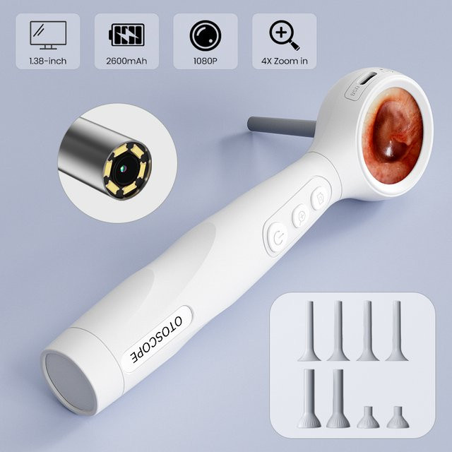 ILIHOME Visuelle Otoskop-Kamera, Digitaler Ohrreiniger, Weiß, Unisex - Bild 1