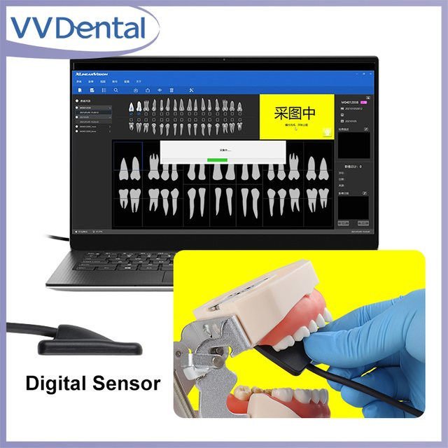 VVDental Tragbarer Dental Eco Sensor RVG X-RAY Intraorales Bildgebungssystem HDR Röntgensensor - Bild 1