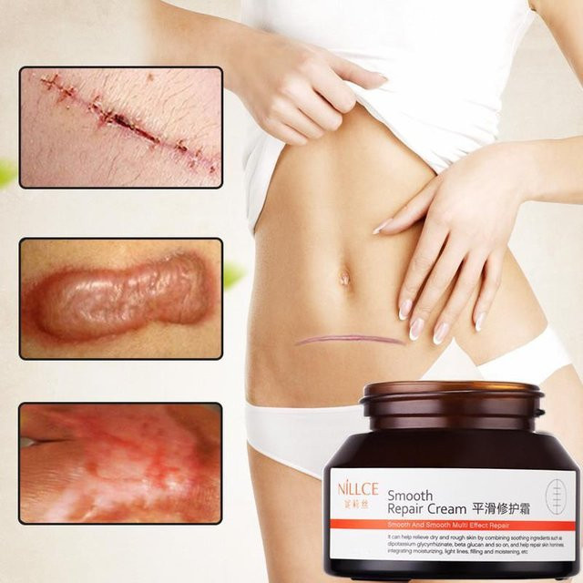 F5 Narbenentfernungscreme, 15g, mit Hyaluronsäure, Kollagen, Vitamin E, Peptide - Bild 1