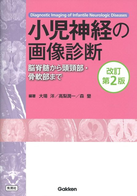 Pädiatrische Neurobildgebung, Überarbeitete 2. Auflage, 大場 洋, 高梨 潤一, 森 聖, Sachbuch - Bild 1