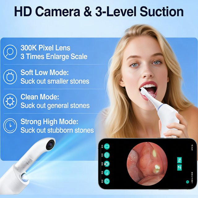 Hailicare Mandelstein-Entfernungsset mit LED-Beleuchtung und HD-Kamera, Unisex - Bild 1