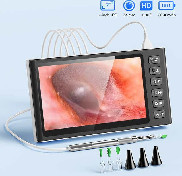 ENWOR Otoskop Kamera mit 7 Zoll IPS-Bildschirm, HD1080P, 3,9mm Linse und 6 LED zur Ohrenreinigung - Bild 1