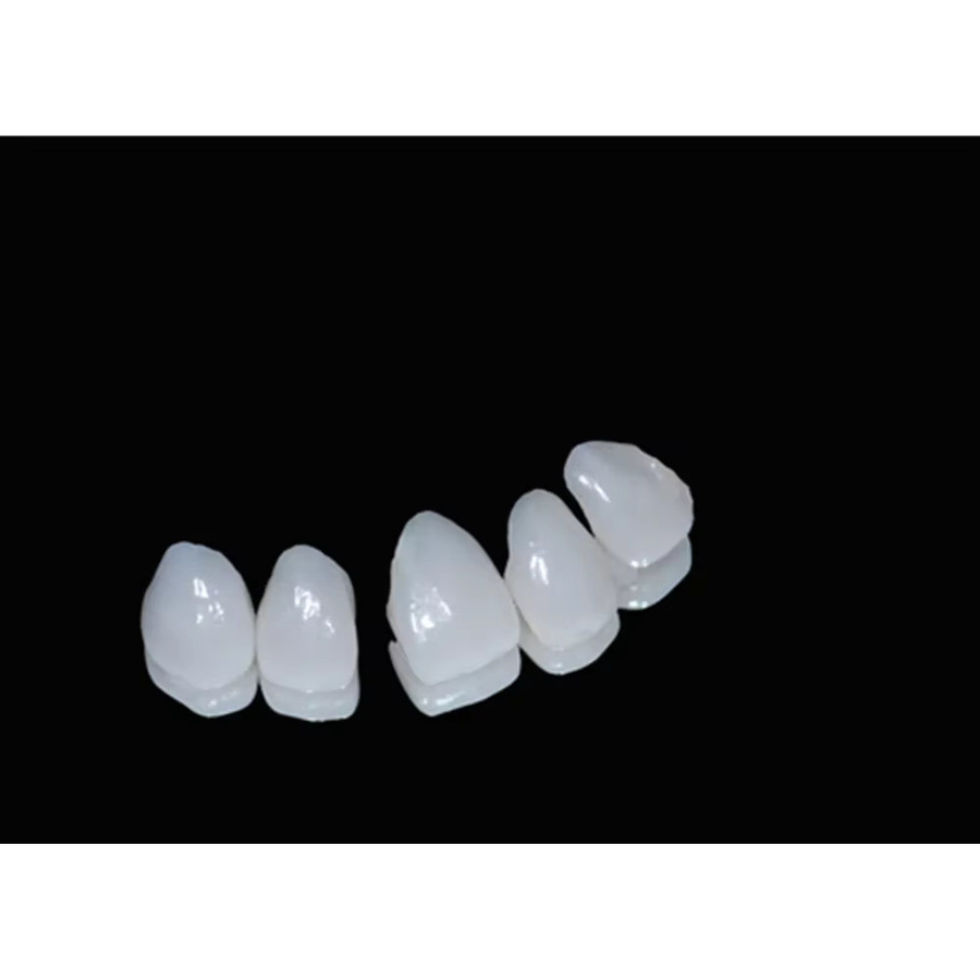 SowSmile Snap-on Smile Veneers zur Zahnlücken-Reparatur - Bild 3