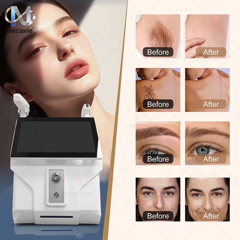 Emsnova Hochfrequenz-Diodenlaser 2-in-1-Gerät, Unisex, White - Bild 4