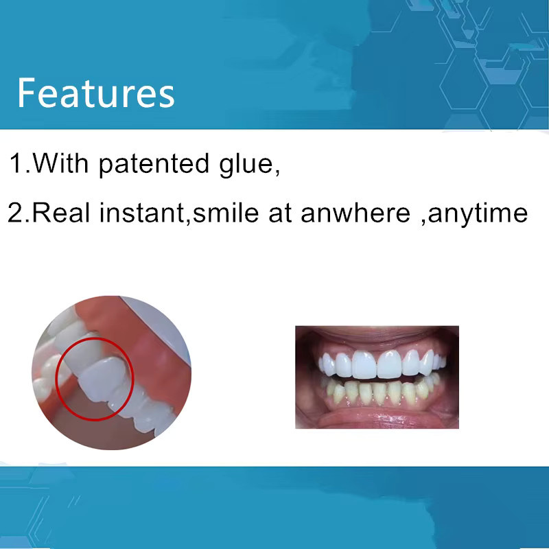 SowSmile Snap-on Smile Veneers zur Zahnlücken-Reparatur - Bild 2