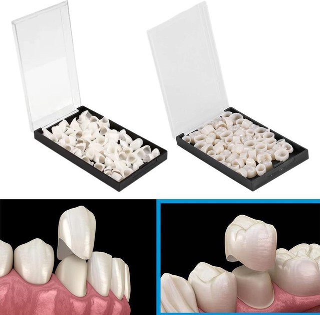 Oralhoe Temporäre Zahnkronen für Vorder- und Hinterzähne - Bild 1