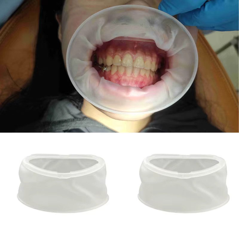 SKATTOOTH Mund Opener Wange Retraktoren, Nicht-Latex, O Form - Bild 2