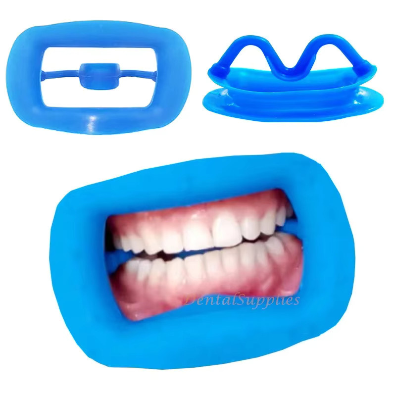 Yaidu Dental Mund Opener, 20 Stück, Silikon Intraorale Unterstützung - Bild 2