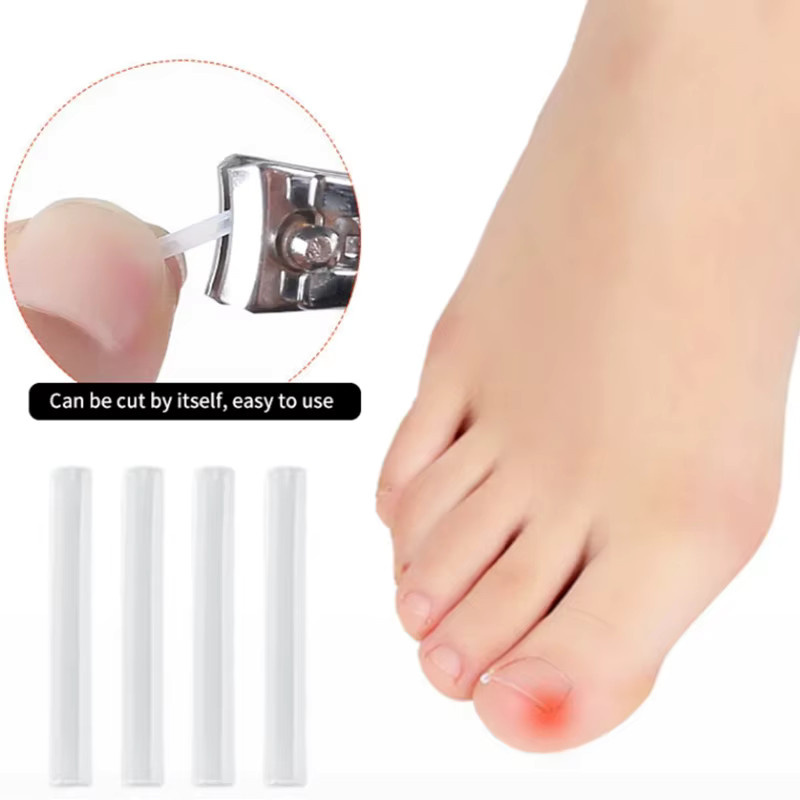 Simpleyibay Korrekturwerkzeug für eingewachsene Zehennägel, Unisex - Bild 2