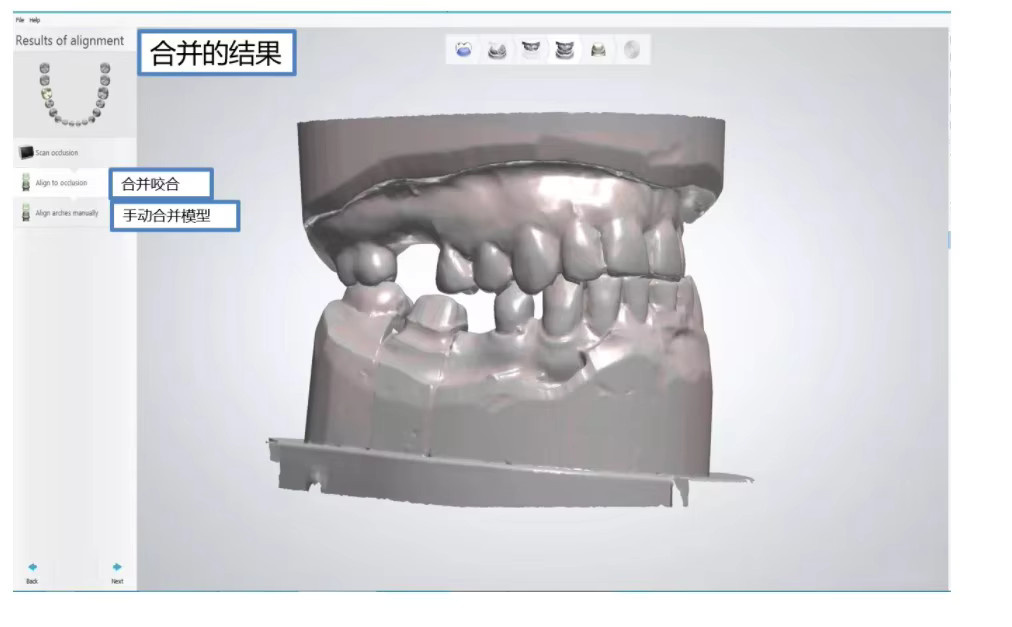 Exocad Smile Design Dentalsoftware Full Version mit Dongle für numerische Steuerung - Bild 3