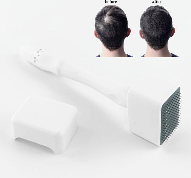 SALORIE Microneedling Gesichtsroller Massagegerät, Unisex, Weiß - Bild 1