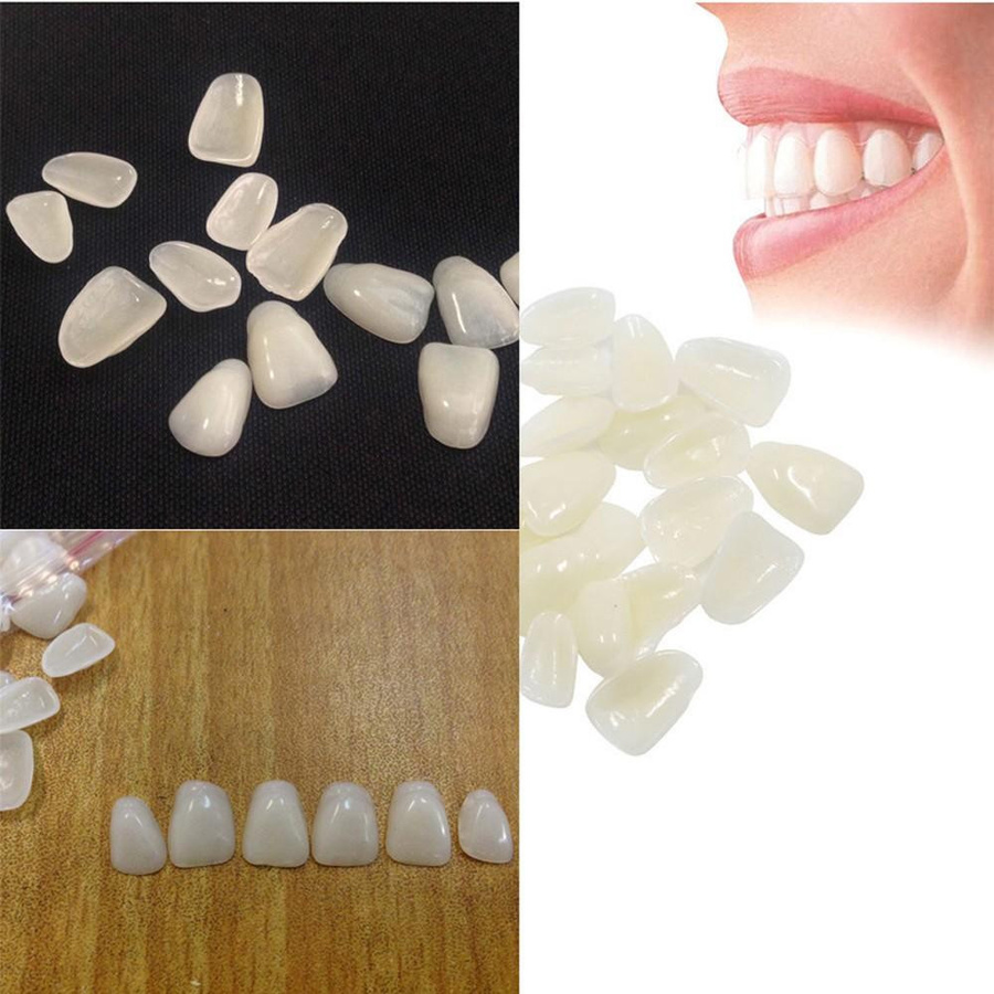 Shihongfeng211 Ultradünne Dentalfilme für Porzellanzähne, Obere Vorderzähne - Bild 4