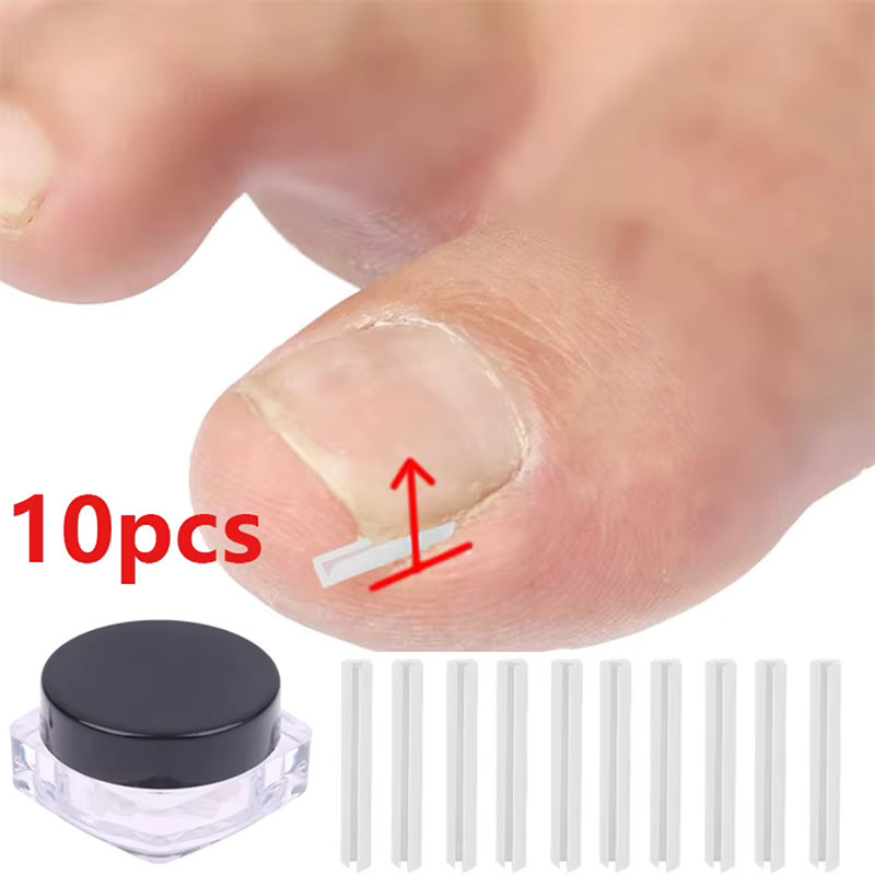 HNKMP Nagelkorrektur-Aufkleber für eingewachsene Zehennägel, 10 Stück, Unisex - Bild 2