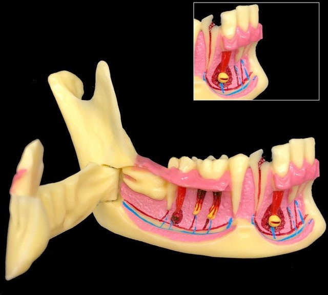 JIECARE Unterkiefer-Dezündungsmodell, anatomisches Modell, Lehrmodell - Bild 1