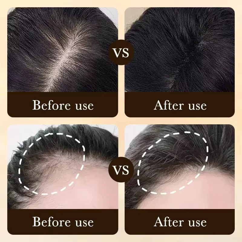 eelhoe Biotin-Öl für Herren, Haare und Kopfhaut - Bild 2
