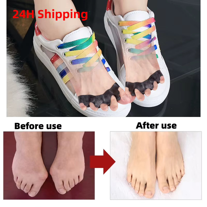 Silikon Zehenseparator Bunion Corrector, Schwarz, Unisex, 2 Stück - Bild 2