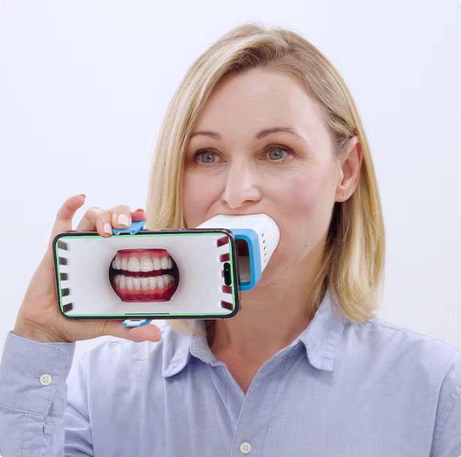NICEDEN Oral mobiles Foto-Positionierungsgerät für die zahnmedizinische und kieferorthopädische Aufzeichnung - Bild 3