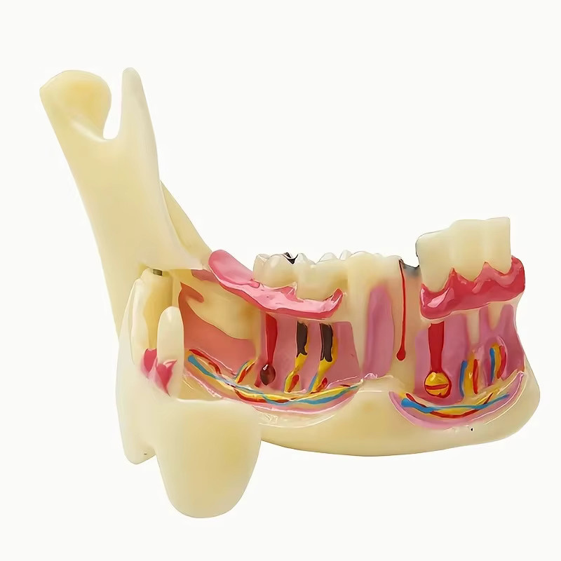 JIECARE Unterkiefer-Dezündungsmodell, anatomisches Modell, Lehrmodell - Bild 2